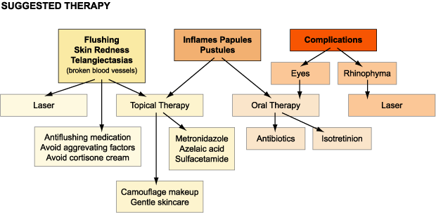 Rosacea Medical Treatment