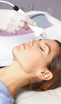 Rosacea IPL Treatment