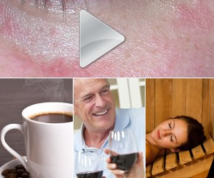 Everything you need to know about acne: watch these videos!